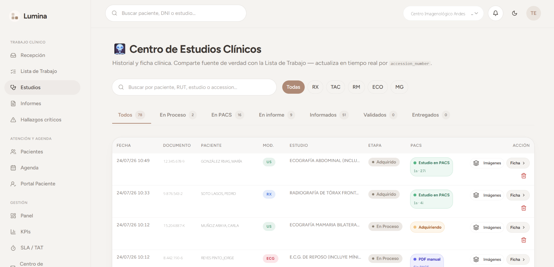 Panel de estudios de Lumina RISPAC con la lista de trabajo radiológica
