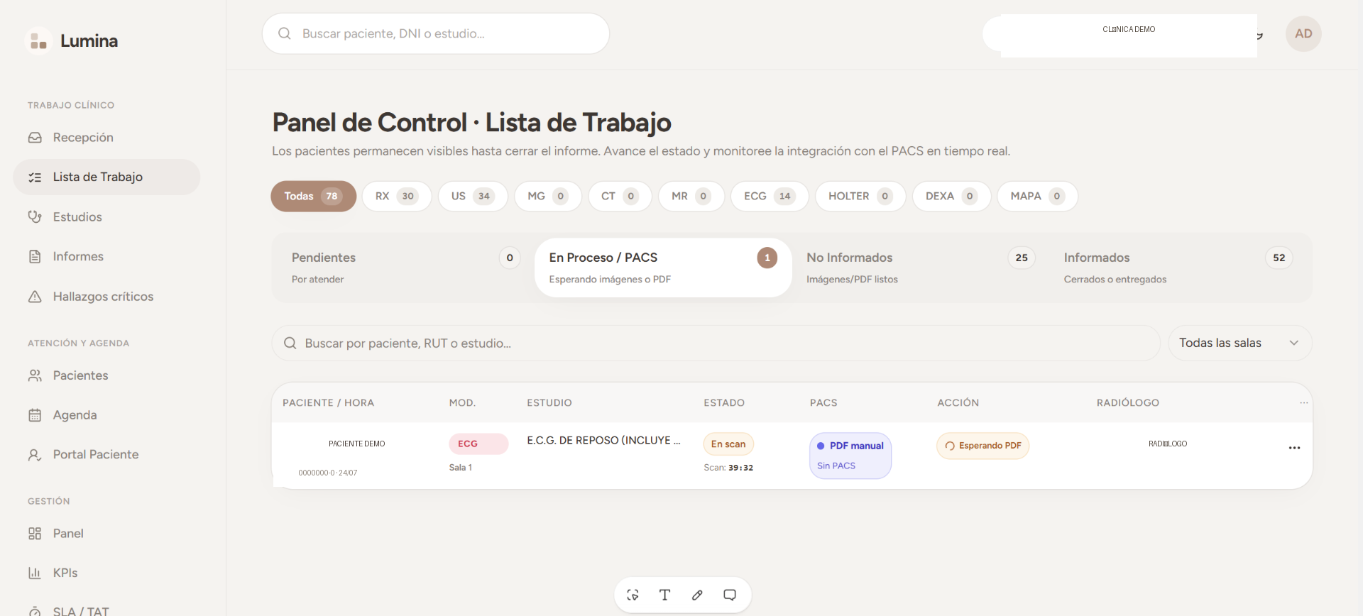 Lista de trabajo radiológica de Lumina RISPAC